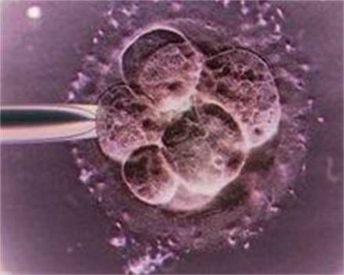 先天性卵巢发育不全如何治疗,借卵子试管婴儿成