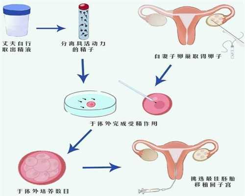 卵巢发育不全的治疗方法,第三代试管选择性别多