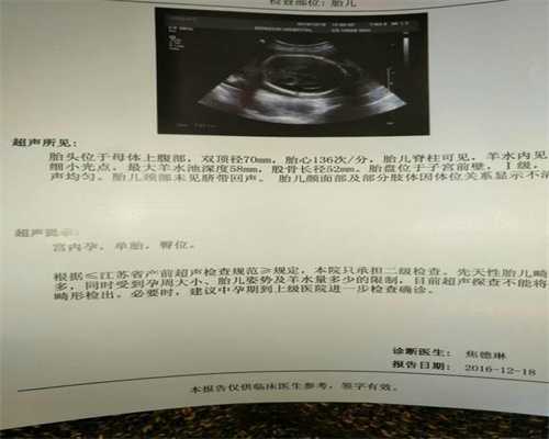 郑州代孕_郑州做代孕的母亲_代孕妇脉搏一分钟跳多少下算正常