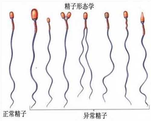 郑州代生宝宝-郑州代孕能挣多少钱-郑州那里做代孕较好