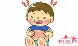 郑州代怀孕孩子上户口，多囊卵巢综合征对试管婴儿有影响吗