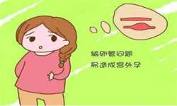 郑州代生母亲咨询，产后睡不好惹上“产后抑郁” 六款安眠食谱来帮忙(2)