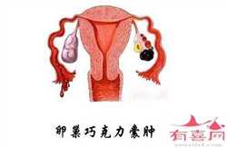 郑州试管借卵~郑州哪有可以做供卵试管，6个月宝宝一次吃多少毫升奶